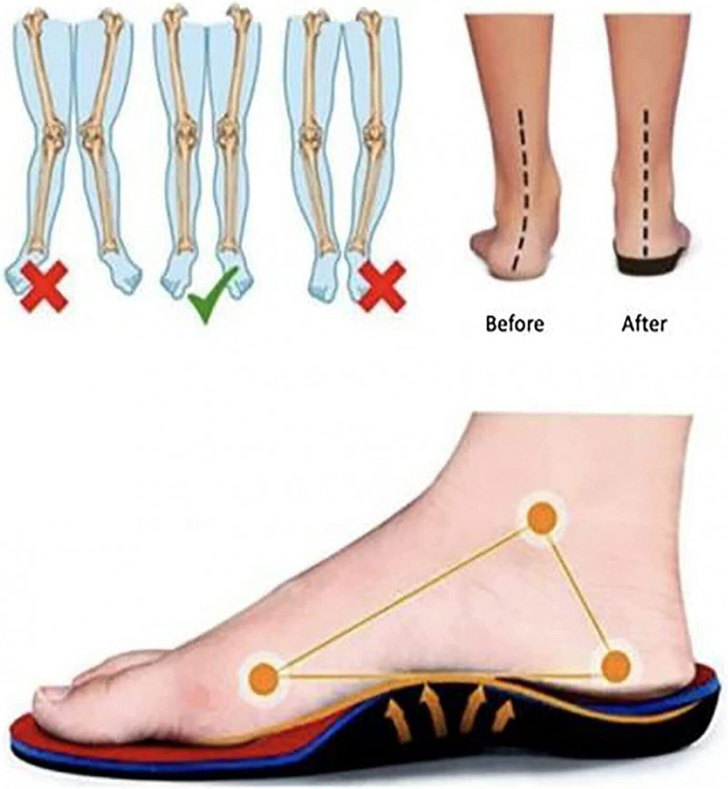 Women’s Orthopedic Walking Shoes Trustilly Fansdeall Sport Comfort Shoes